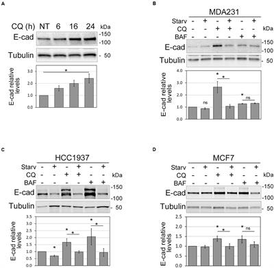 The Autophagy Machinery Contributes to E-cadherin Turnover in Breast Cancer